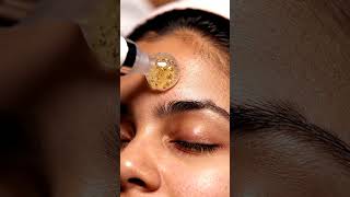 “Millions of Tiny Whiteheads Removed Instantly | Ultra Close-Up Vacuum Suction”
