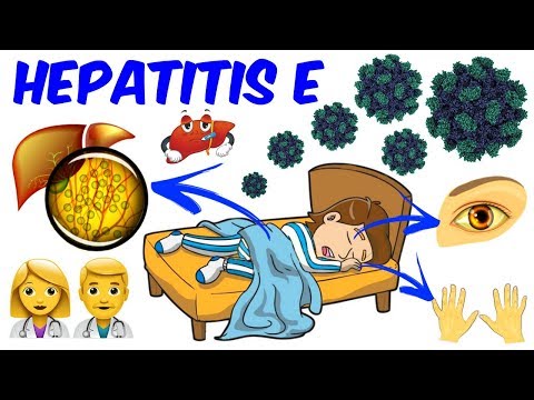 Video: Zirkulierende MiR-122-Spiegel Bei Sich Selbst Erholenden Hepatitis-E-Patienten