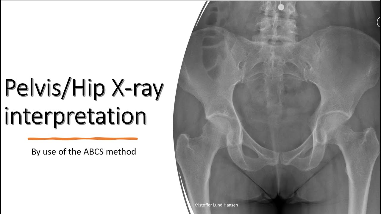 Pelvis Anatomy Xray Hq720