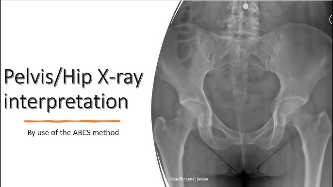 How to SHOOT PELVIS and HIP X-RAYS 