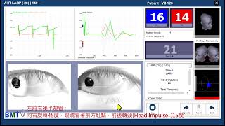 3D VHIT 六半規管頭部脈衝 : Testing of all 6 canals with vhit #六半規管頭部脈衝