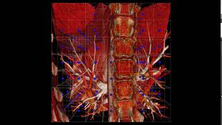 Celebrity AtomicusChart®: Volume Rendering Customizations Profile