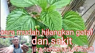How to Relieve the Pain/Itch from LATENG PLANTS If You Accidentally Touch Them with Your Hands or...
