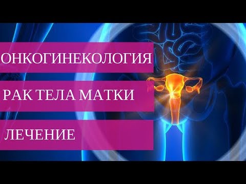 Видео: 3 начина за лечение на възпаление на матката