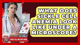 What Does Sickle Cell Anemia Look Like Under A Microscope? - Sickle Cell Wellness Guide