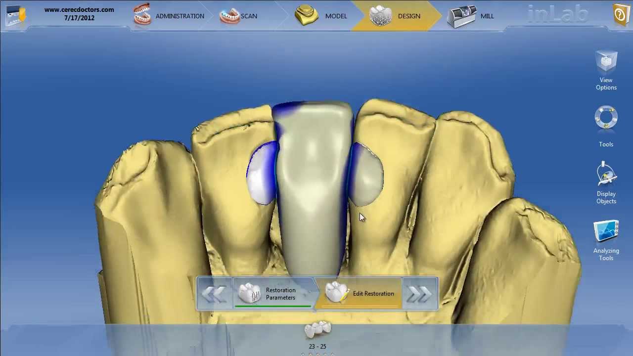 inLAB 4.0 Maryland Bridge with Anatomic Connectors YouTube