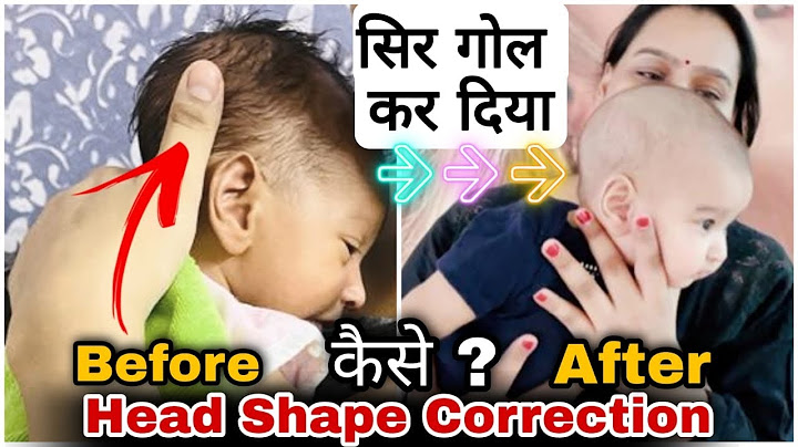 Bache ka sir kaise gol kare -baby head shape correction - Priya vlogs 2022-post pregnancy vlogs 2022