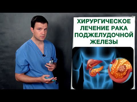 Рак поджелудочной железы - хирургическое лечение. Врач-онколог Владимир Лядов.