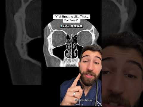 4 признака искривления носовой перегородки