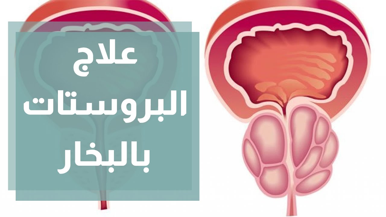 علاج تضخم البروستات بالبخار