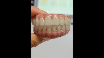 Zirconia full mouth bridge     #zirconiaimplants #dentalimplants #LuxArch