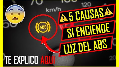 Se PRENDE LA LUZ Del ABS En El TABLERO ? 🔥ESTAS SON LAS 5 CAUSAS🔥