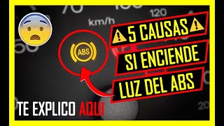 ⚠ Se PRENDE LA LUZ Del ABS En El TABLERO ? ESTAS SON LAS 5 CAUSAS