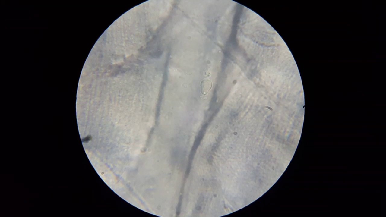 Something Moving in a Sample of Meat under the Microscope - YouTube
