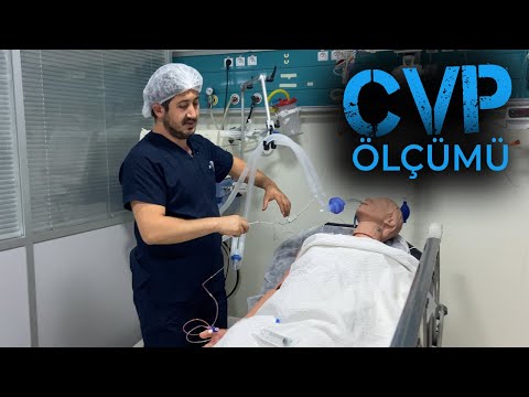 Santral venöz basınç