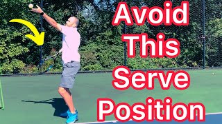 Don’t Make This Common Serve Mistake (Easy Tennis Waiter’s Tray Solution)