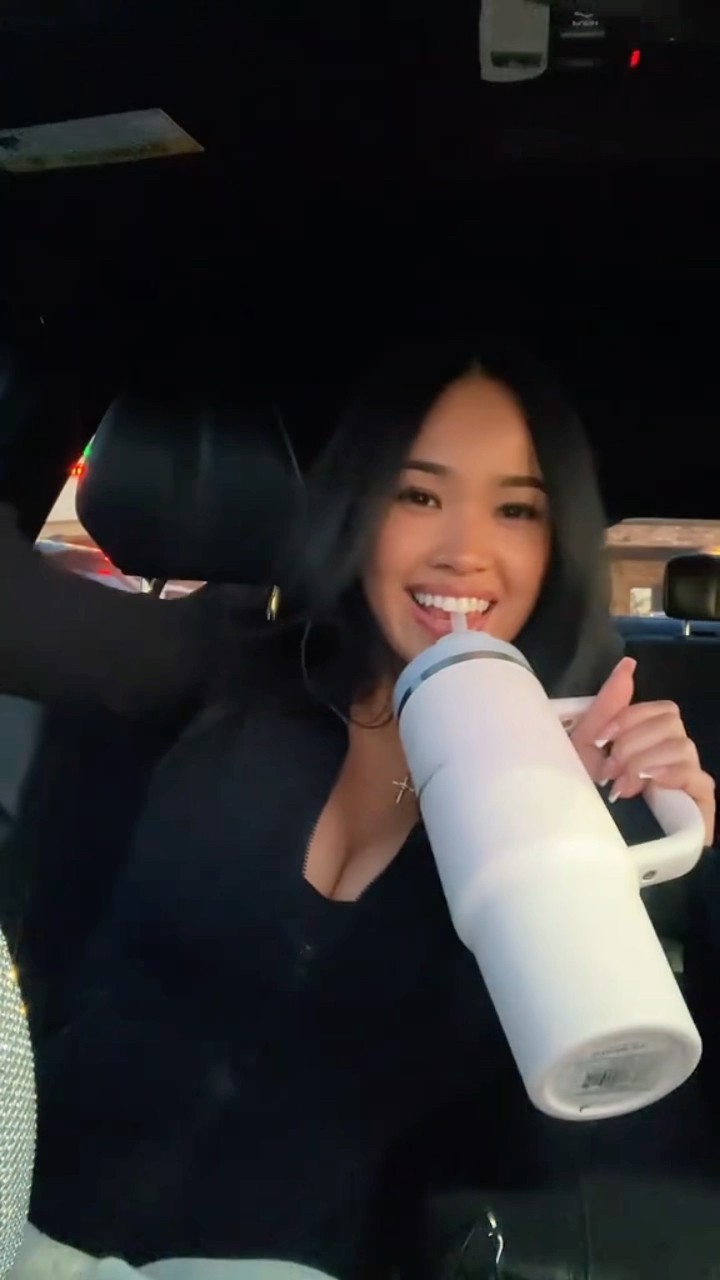 Why her teeth so perfect ?