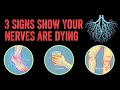 3 Signs Show Your Nerves Are Dying | Symptoms Health (Medical Review)