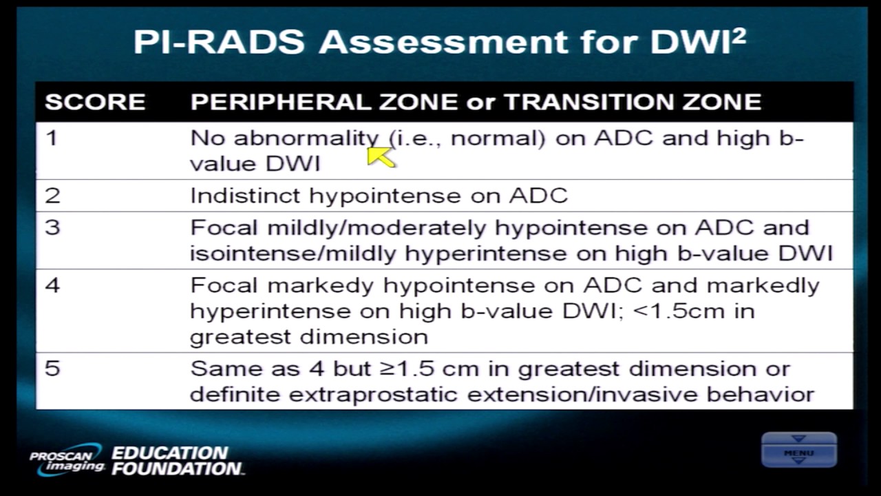 Prostate mri pi rads 4