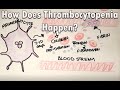 How does thrombocytopenia happen | Low platelets and the COVID vaccine