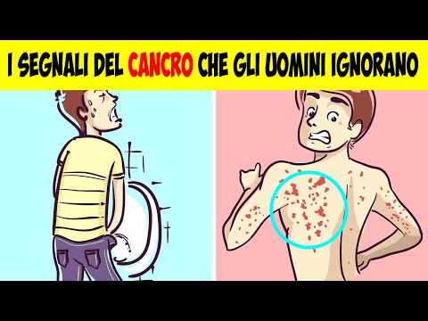 Video: Sgabelli Maleodoranti: Cause, Segni E Prevenzione