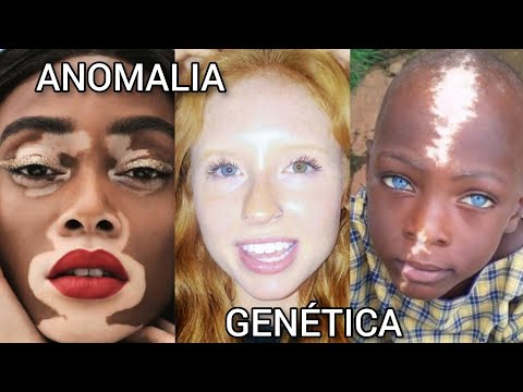 Vídeo: Anomalias genéticas em ratos