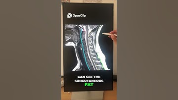 How to read Cervical spine MRI? #anatomy #radiology