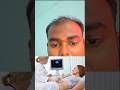 प्रेगनेंसी में अल्ट्रासाउंड कब और कितनी बार करवाना चाहिए? । #trending #shorts