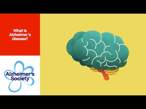 Por que a doen&#231;a de Alzheimer &#233; um problema para a sociedade?