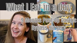 What I Eat in a Day 9 Months Post Gastric Bypass RNY Surgery