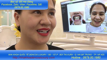 LÀM RĂNG KHỂNH CHO NỤ CƯỜI DUYÊN