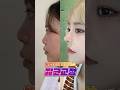낮은 콧대 콤플렉스, 짧은코 교정 🎀#제로원성형외과 #낮은코 #짧은코 #낮은콧대 #짧은코교정 #복코  #강남역성형외과 #고영일#shorts