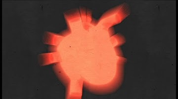 5. Sochi: Extreme conditions