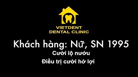 Điều trị cười hở lợi - Cắt nướu, làm dài thân răng