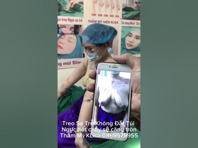 nâng cấp vòng 1