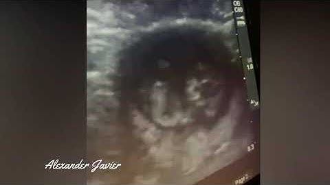 Carta de un Bebé que está por Nacer 💌🖋👶🤰