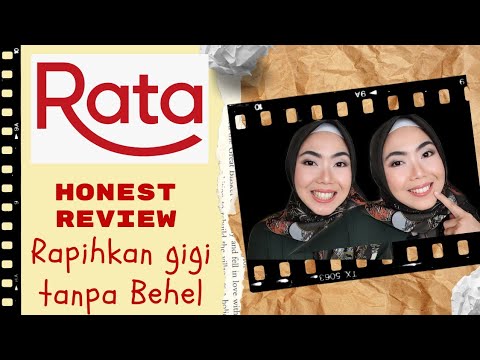 HONEST REVIEW RATA ID Part 1 CLEAR ALIGNER  MERAPIKAN 