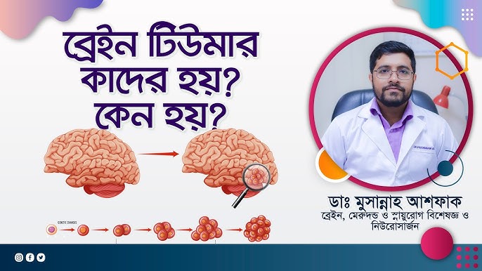 মস্তিষ্কের টিউমার: কারণ, লক্ষণ এবং প্রতিরোধের উপায়