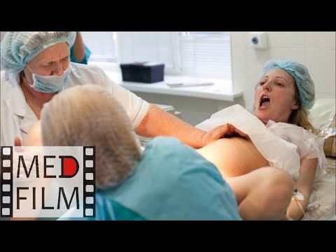 Video: Vaginalni Prsten Za Kontrolu Rađanja
