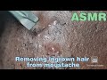 ASMR Upclose Zoom Removing ingrown hair from beard & moustache