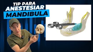 Great hack to numb the mandible by Dr. Federico Baena Q 5,327 views 3 days ago 5 minutes, 44 seconds