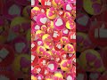 Cirugia 3d