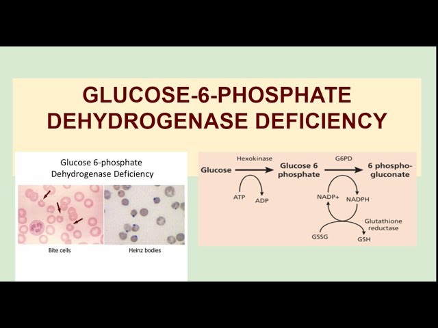 G6PD deficiency: Basics, Categories, lab investigations