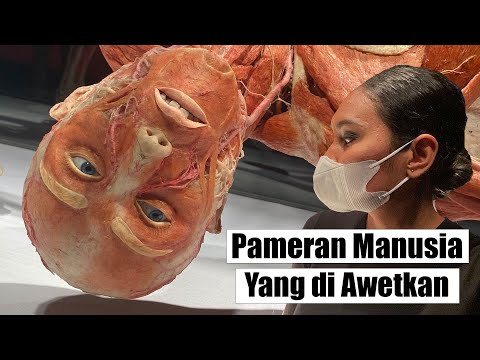 Video: Museum Anatomi. Pameran mengejutkan dari museum anatomi dunia