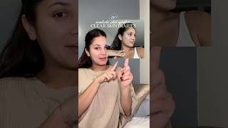 realistic acne skin update 🧖🏼♀️ #shorts #acneprone #skincare #realistic #acne #azelaicacid