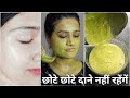 No- Pimples/Sun-Tan, Get Glowing Skin| चेहरे से नाकि दाने/पिंपल ख़त्म हुए बल्कि उनके निशान भी गायब|