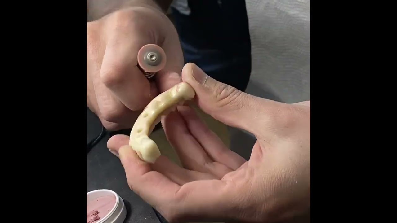 Pink Polish Protocol: Achieving a High-Polished Zirconia Finish