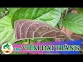 Thần dược chữa bệnh Viêm ��ại tràng Lá mơ lông - Bài Thuốc Nam |namdaik