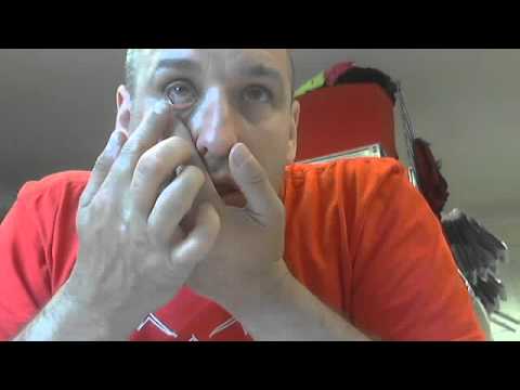 Putting Zovirax Into My Eye.