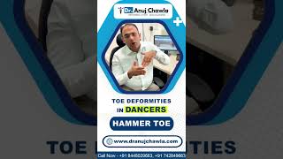 Toe deformities in Dancers -  Hammer Toe